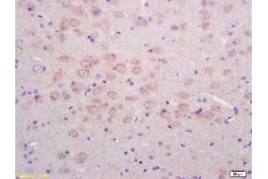 Formalin-fixed and paraffin embedded rat brain labeled with Rabbit Anti Phospho-NMDAR1(Ser890) Polyclonal Antibody, Unconjugated (ABIN744278) at 1:200 followed by conjugation to the secondary antibody and DAB staining