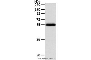 Western blot analysis of Human leiomyosarcoma tissue, using NPY1R Polyclonal Antibody at dilution of 1:400 (NPY1R antibody)