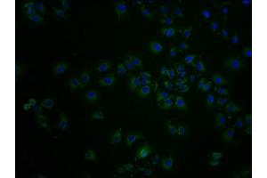 Immunofluorescence staining of A549 cells with ABIN7143977 at 1:100, counter-stained with DAPI. (SCNN1D antibody  (AA 292-519))