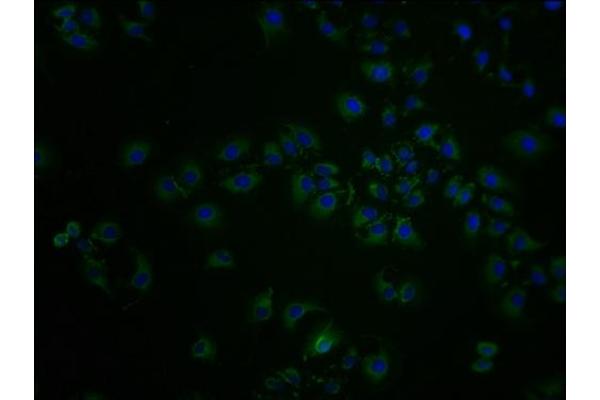 SCNN1D Antikörper  (AA 292-519)
