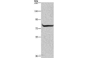 Western blot analysis of 293T cell, using GYS1 Polyclonal Antibody at dilution of 1:300