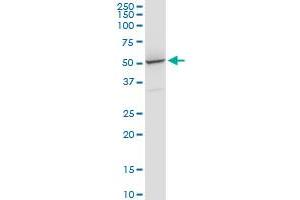 PRPF31 monoclonal antibody (M02), clone 8E1. (PRPF31 antibody  (AA 400-499))