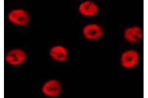 ABIN6274006 staining Hela by IF/ICC. (DGCR8 antibody  (C-Term))