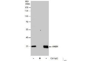 Immunoprecipitation (IP) image for anti-Hydroxyacyl-CoA Dehydrogenase (HADH) antibody (ABIN2856051)