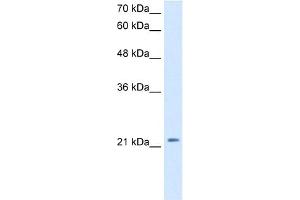 WB Suggested Anti-DKK1 Antibody Titration:  2. (DKK1 antibody  (C-Term))