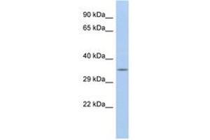 Image no. 1 for anti-Calbindin 2 (CALB2) (AA 71-120) antibody (ABIN6744290) (Calretinin antibody  (AA 71-120))