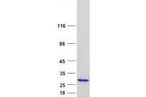 Coiled-Coil Domain Containing 12 (CCDC12) (Coiled coil domain) protein (Myc-DYKDDDDK Tag)