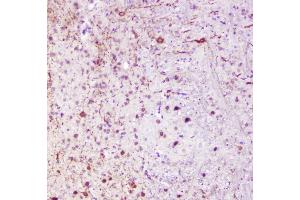 IHC analysis of Calbindin using anti-Calbindin antibody (ABIN6719541). (CALB1 antibody  (AA 2-261))