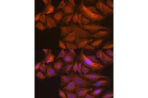 Immunofluorescence (IF) image for anti-TANK-Binding Kinase 1 (TBK1) antibody (ABIN7270723)
