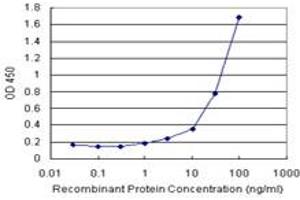 Sandwich ELISA detection sensitivity ranging from 1 ng/mL to 100 ng/mL. (B2M (Human) Matched Antibody Pair)