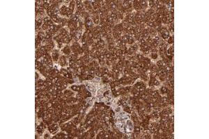 Immunohistochemical staining of human liver with SH2D4A polyclonal antibody  shows strong cytoplasmic positivity in hepatocytes at 1:50-1:200 dilution. (SH2D4A antibody)