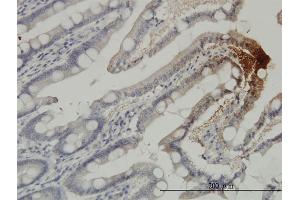 Immunoperoxidase of monoclonal antibody to THTPA on formalin-fixed paraffin-embedded human small Intestine. (THTPA antibody  (AA 1-230))