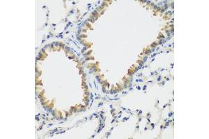 Immunohistochemistry of paraffin-embedded mouse lung using VEGFR3/FLT4 antibody (ABIN6130780, ABIN6140699, ABIN6140702 and ABIN6221242) at dilution of 1:200 (40x lens). (FLT4 antibody  (AA 1174-1363))