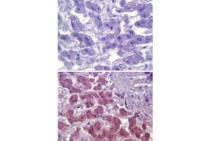 Immunohistochemical analysis of TLR6 in paraffin-embedded formalin-fixed human liver tissue using an isotype control (top) and TLR6 monoclonal antibody, clone 86B1153. (TLR6 antibody  (AA 408-424))