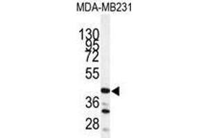 Image no. 1 for anti-Cathepsin S (CTSS) (Middle Region) antibody (ABIN452893) (Cathepsin S antibody  (Middle Region))