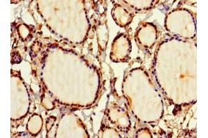 Immunohistochemistry of paraffin-embedded human thyroid tissue using ABIN7169707 at dilution of 1:100