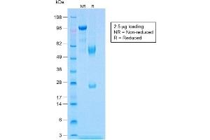 SDS-PAGE (SDS) image for anti-Calponin 1 (CNN1) antibody (ABIN6939166)