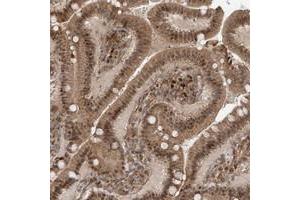 Immunohistochemical staining of human duodenum with ATAD2B polyclonal antibody  shows moderate cytoplasmic and nuclear positivity in glandular cells at 1:50-1:200 dilution. (ATAD2B antibody)