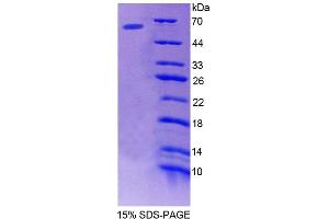 SDS-PAGE analysis of Human bACE1 Protein.