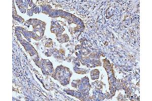 IHC analysis of Grp75 using anti-Grp75 antibody (ABIN7602782). (HSPA9 antibody  (C-Term))