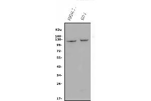 Western blot analysis of CD30/TNFRSF8 using anti-CD30/TNFRSF8 antibody (ABIN7603165).
