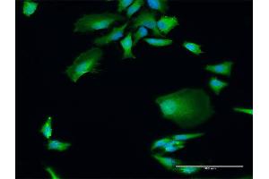 Immunofluorescence of purified MaxPab antibody to DGCR8 on HeLa cell. (DGCR8 antibody  (AA 1-773))