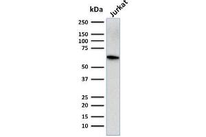 Western Blot Analysis of human Jurkat cell lysate using CD5-Monospecific Mouse Monoclonal Antibody (CD5/2416). (CD5 antibody  (AA 269-366))