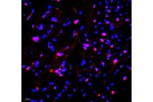 Immunofluorescence of paraffin embedded mouse heart using PRPF3 (ABIN7075311) at dilution of 1: 2200 (400x lens) (PRPF3 antibody)