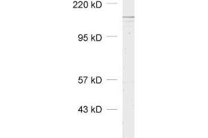 dilution: 1 : 1000, sample: cell lysate of mouse 3T3 fibroblasts (ADAR antibody)