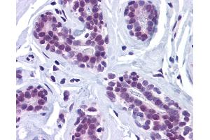 Anti-RBBP8 / CTIP antibody IHC of human breast. (Retinoblastoma Binding Protein 8 antibody  (Internal Region))