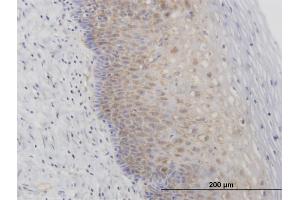 Immunoperoxidase of purified MaxPab antibody to RPL29 on formalin-fixed paraffin-embeddedhuman uterine cervix. (RPL29 antibody  (AA 1-159))
