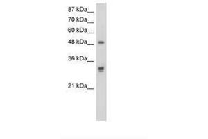 Image no. 1 for anti-DEAD (Asp-Glu-Ala-As) Box Polypeptide 19B (DDX19B) (AA 382-431) antibody (ABIN203175) (DDX19B antibody  (AA 382-431))