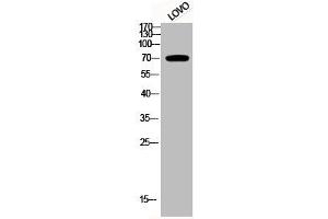 Western Blot analysis of LOVO cells using Phospho-p70 S6 kinase α (T229) Polyclonal Antibody (RPS6KB1 antibody  (pThr229))