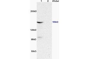 L1 rat heart, L2 rat brain lysates probed (ABIN683128) at 1:200 in 4 °C. (ASK1 antibody  (pThr845))