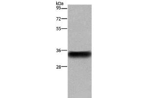Western Blot analysis of Human placenta tissue using CD32 Polyclonal Antibody at dilution of 1:850 (Fc gamma RII (CD32) antibody)