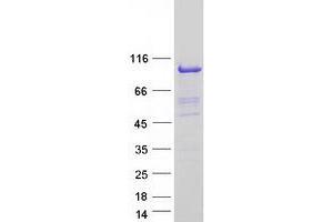 Validation with Western Blot