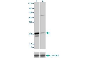 Western blot analysis of MS4A7 over-expressed 293 cell line, cotransfected with MS4A7 Validated Chimera RNAi (Lane 2) or non-transfected control (Lane 1). (MS4A7 antibody  (AA 1-240))