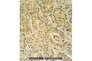 Immunohistochemistry (IHC) image for anti-UBA Domain Containing 1 (UBAC1) antibody (ABIN3002317) (UBAC1 antibody)
