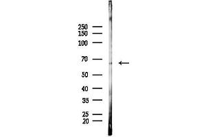 anti-Interferon Regulatory Factor 7 (IRF7) antibody