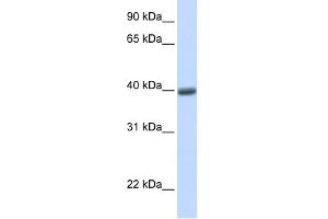 WB Suggested Anti-MAGEA1 Antibody Titration:  0. (MAGEA1 antibody  (N-Term))