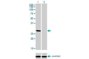 Western blot analysis of DLX4 over-expressed 293 cell line, cotransfected with DLX4 Validated Chimera RNAi (Lane 2) or non-transfected control (Lane 1). (DLX4 antibody  (AA 1-98))