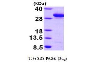 SDS-PAGE (SDS) image for RAB27A, Member RAS Oncogene Family (RAB27A) (AA 1-221) protein (His tag) (ABIN666995)