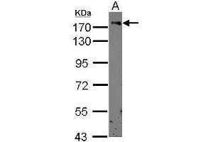 WB Image Sample (30 ug of whole cell lysate) A: THP-1 7. (CD11b antibody  (Center))