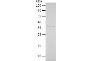 Stathmin 1 Protein (STMN1) (AA 64-149) (His-IF2DI Tag)