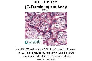 Image no. 2 for anti-Epoxide Hydrolase 2, Cytoplasmic (EPHX2) (C-Term) antibody (ABIN1734088) (EPHX2 antibody  (C-Term))
