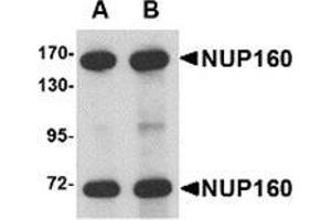 Western blot analysis of NUP160 in rat brain tissue lysate with NUP160 antibody at (A) 0.