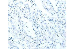 Immunohistochemistry (IHC) image for anti-Cadherin 23 (CDH23) antibody (ABIN1871707)