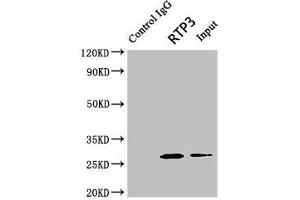 Immunoprecipitating RTP3 in Mouse brain tissue Lane 1: Rabbit control IgG (1 μg) instead of ABIN7167488 in Mouse brain tissue. (RTP3 antibody  (AA 1-211))