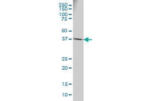 RPSA monoclonal antibody (M01A), clone 8G4 Western Blot analysis of RPSA expression in HeLa . (RPSA/Laminin Receptor antibody  (AA 196-295))