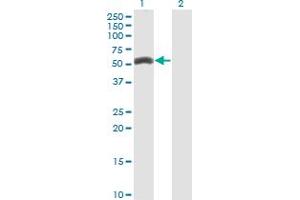 Western Blot analysis of ZNF239 expression in transfected 293T cell line by ZNF239 monoclonal antibody (M27), clone 2D9.